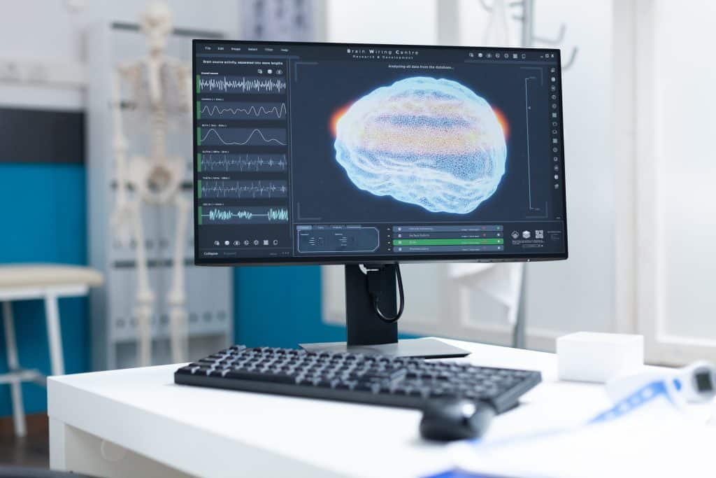 visualisation 3D en medecine